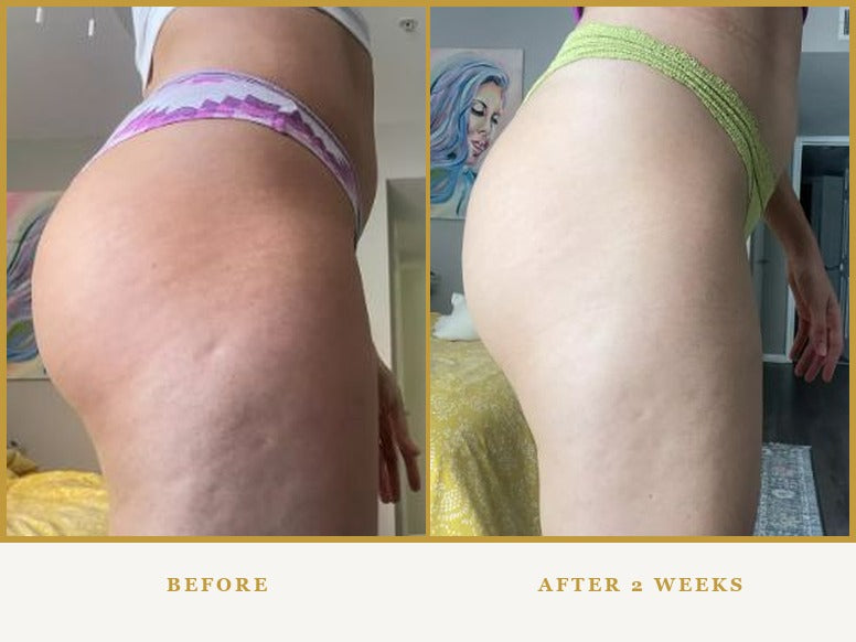 Before and after, Butt, two weeks
