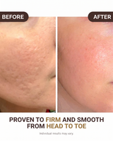 Cryo Thermo Gold Body Firming Gel
