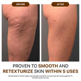 Cryo Thermo Gold Body Firming Gel