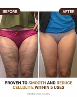 Cryo Thermo Gold Body Firming Gel