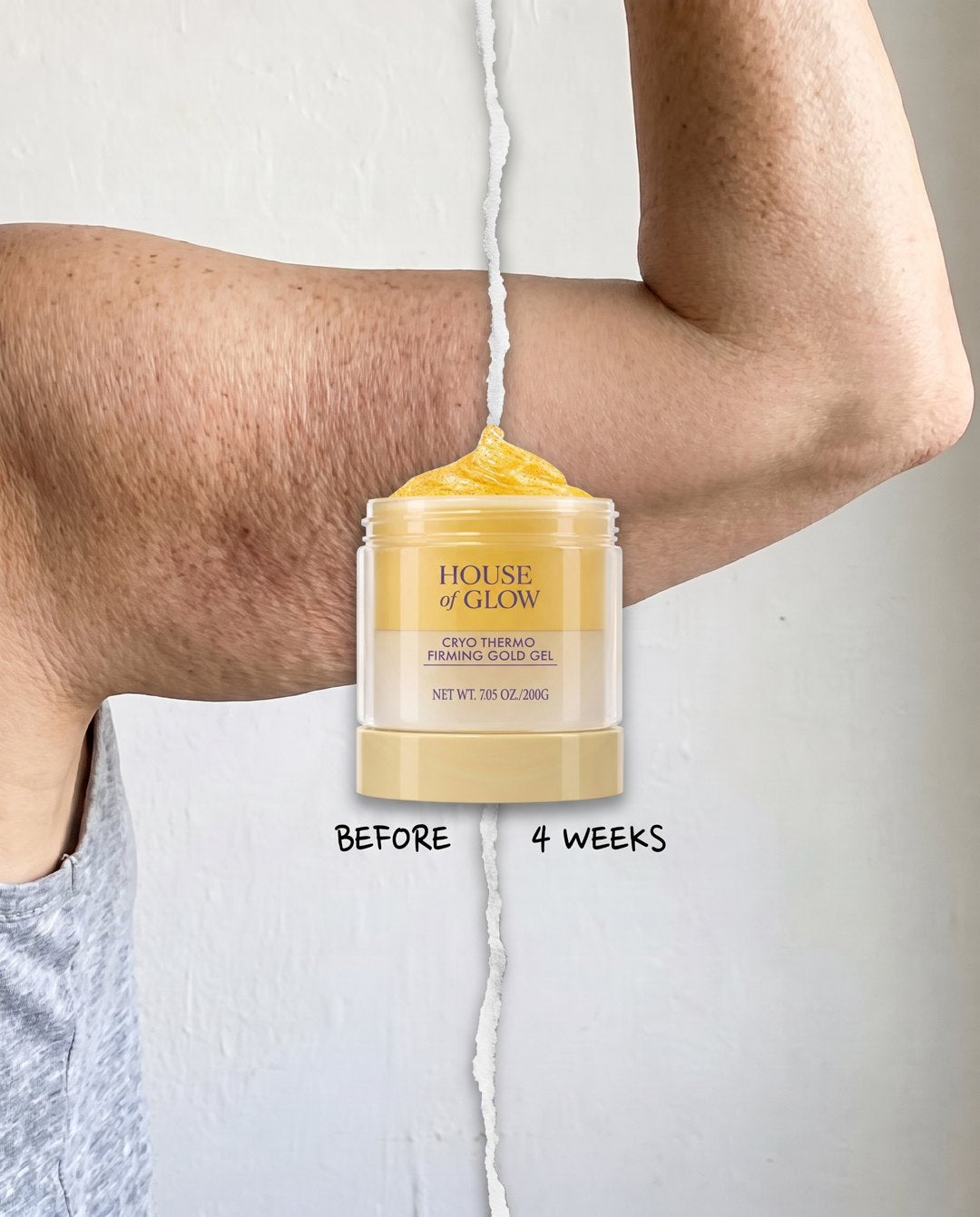 Before, and after two weeks: crepey upper arm now firm and smooth