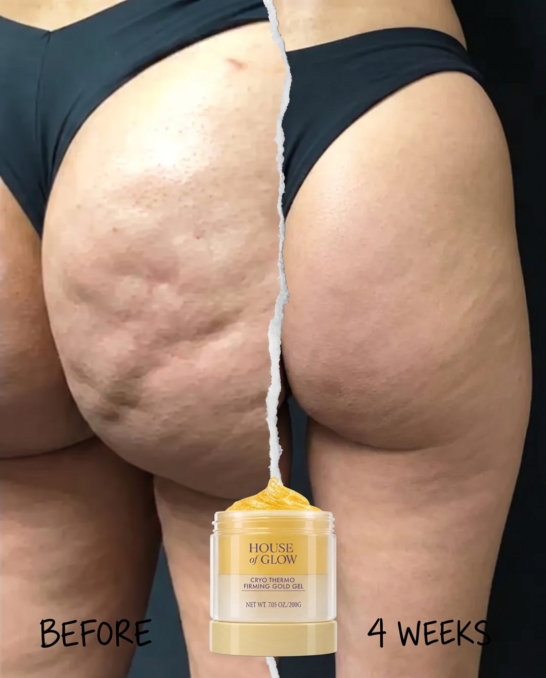 Before, and after two weeks: cellulite smoothed, skin firm and lifted