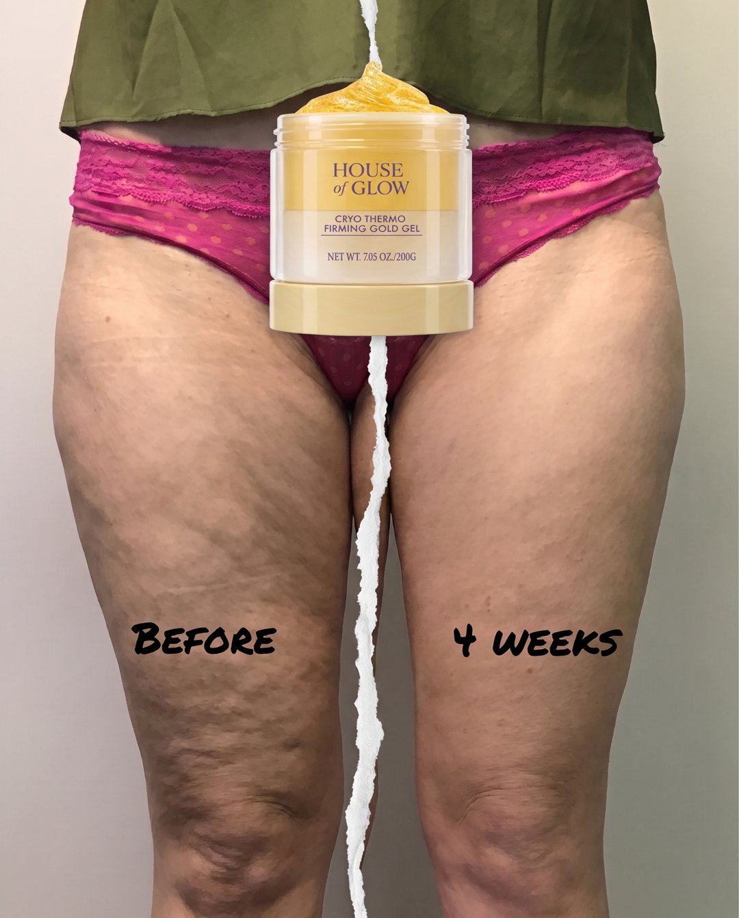 Before and after two weeks: cellulite on the thigh, then smooth and firm