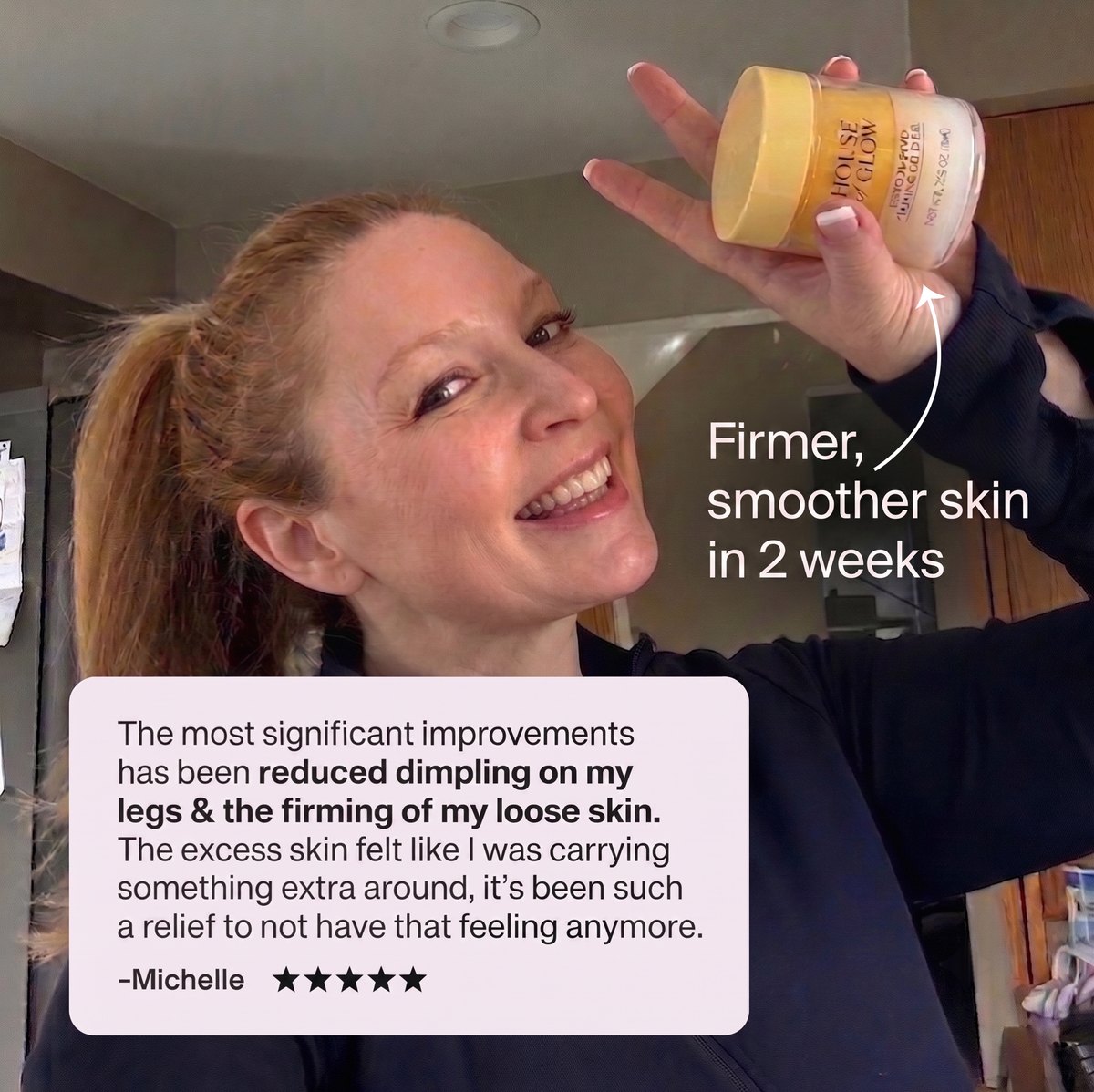 Michelle, five stars: the most significant improvements have been reduced dimpling on my legs and the firming of my loose skin